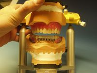Bild zu Neue Zähne-Dentaltechnik Jörg Martin Hundt Dentallabor
